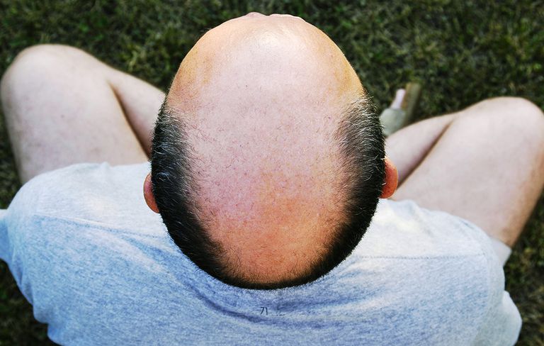 5 Best Moisturizers for Bald Head to Use During Summer
