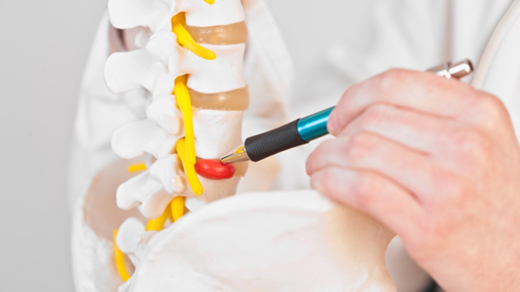 What is Herniated Disc Surgery