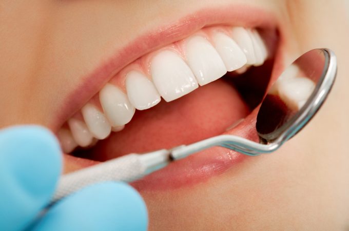 Types of Cosmetic Dentistry
