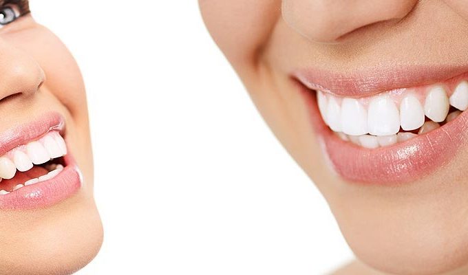 What Are the Most Popular Cosmetic Dentistry Procedures These Days?