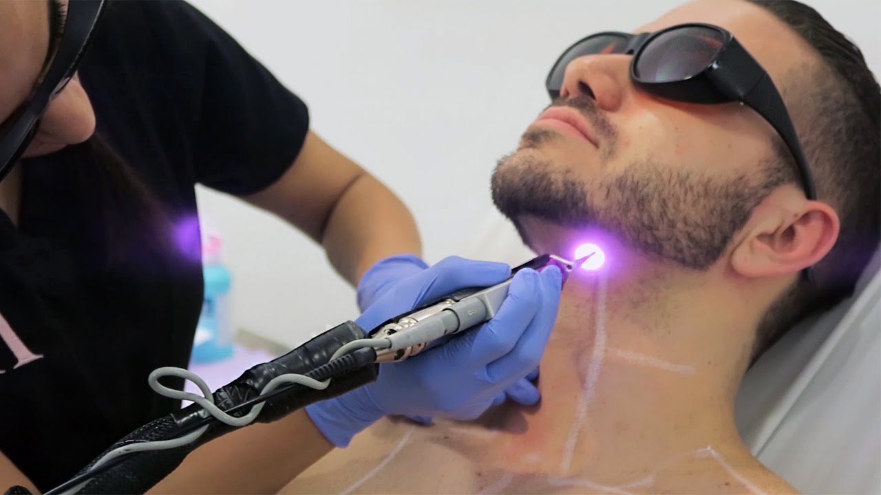 Blue Ray Hair Removal for Men - wide 5