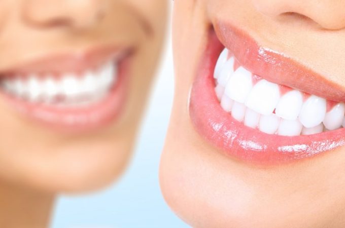 6 Cosmetic Dental Problems That Lumineers Address