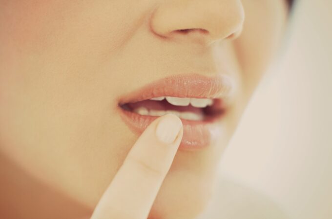 7 Must Know Cold Sore Facts