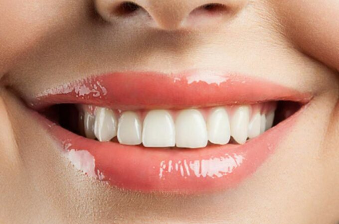 How to Keep Your Teeth and Gums Healthy Over The Festive Season