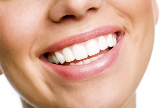 The Time-Tested Benefits of Teeth Whitening Treatments