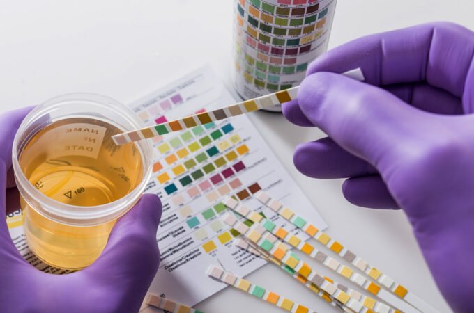 Are Home Drug Test Kits Reliable?