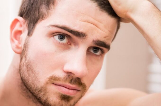 Why Do Men Lose Their Hair?