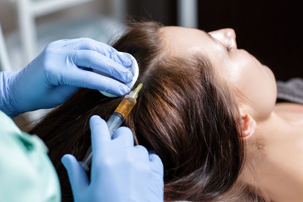What is the Process of a Hair Transplant?