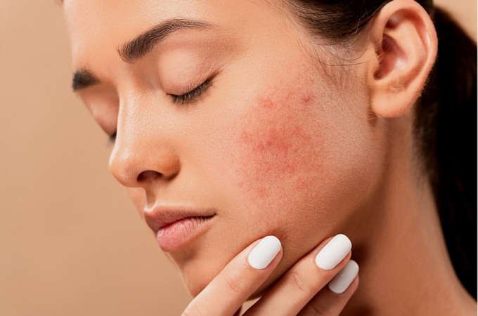 Save Your Skin – 6 Signs It’s Time to Find A New Dermatologist