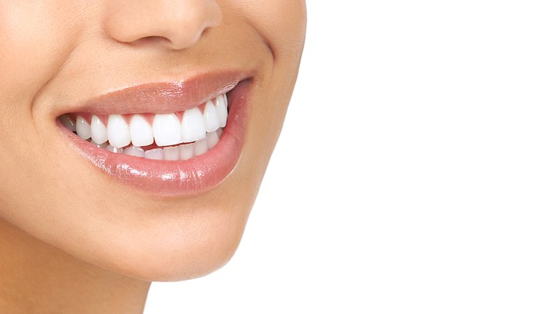 Veneers Singapore: Who does Veneers near Me?