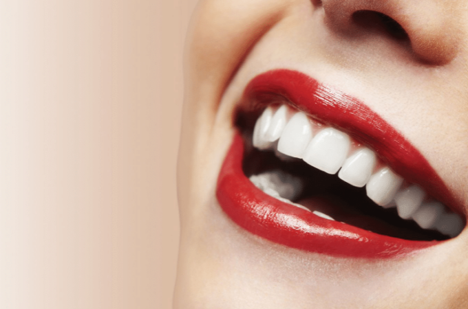 Are You Thinking about Invisalign Sydney? Read This First