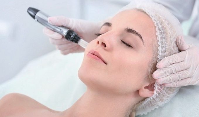 Skin Needling Treatments, Overview and Benefits