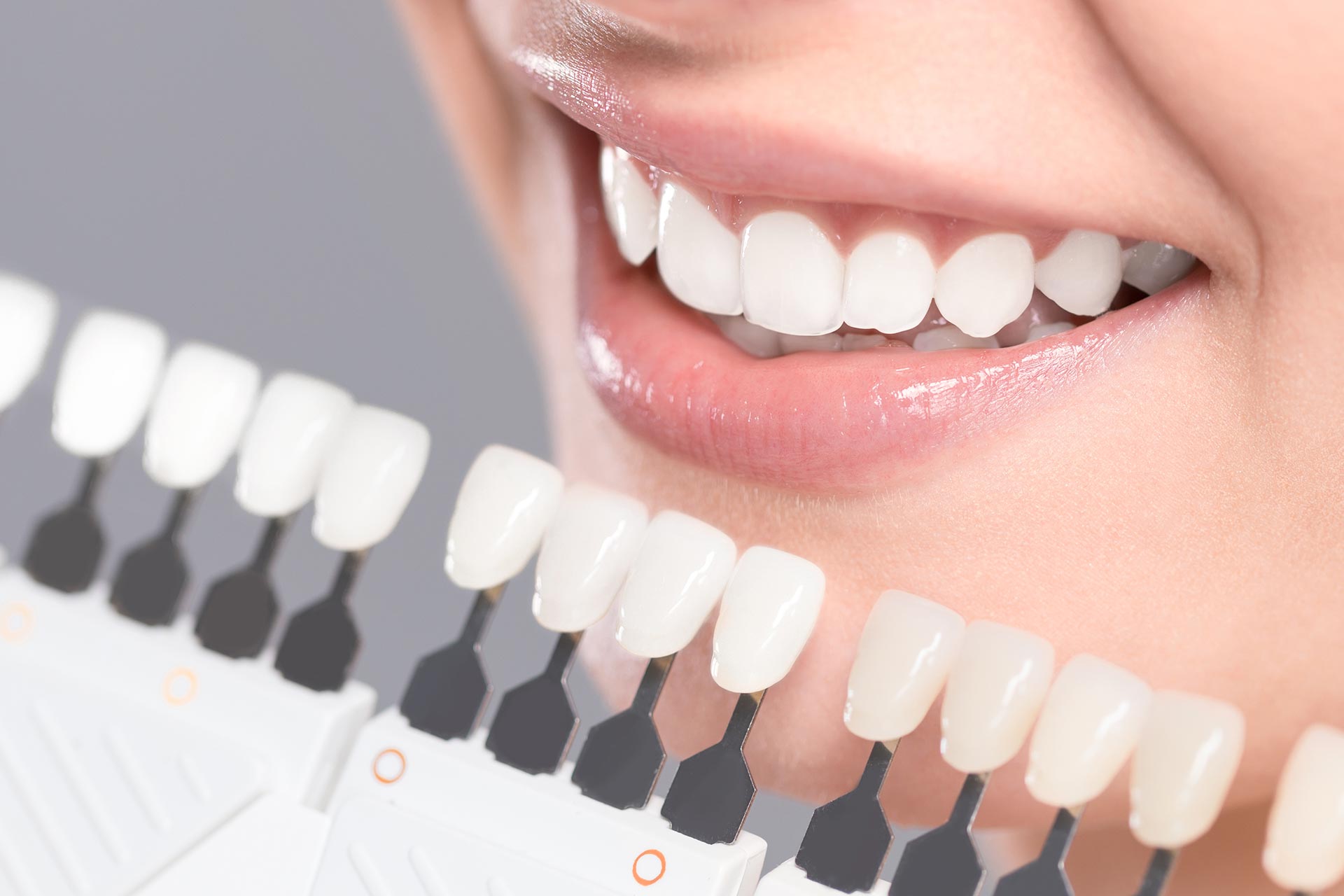 Considering Cosmetic Dentistry? What You Should Know Beforehand