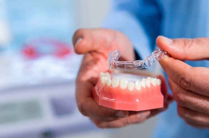 Understanding Invisalign Costs: A Deep Dive